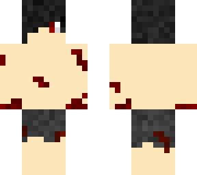 injured