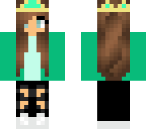 scleroderma queen