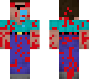 noob skin horror
