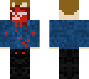 dead boy