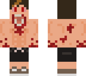 infected teenage male shirtless w/ gym shorts