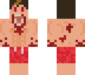 infected teenage male w/ swimwear