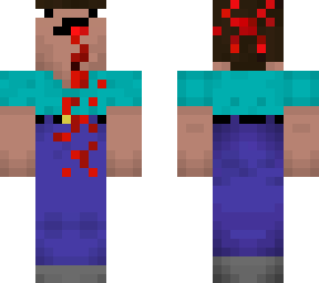 dead noob
