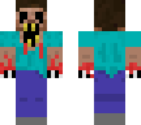 anomaly358 fixed