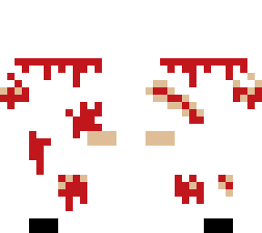 dead person (without leg or head or arm)