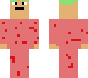 crazy noob