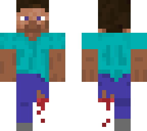 steve lost a leg!!!