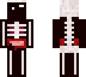 x-ray