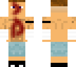 andr wounded