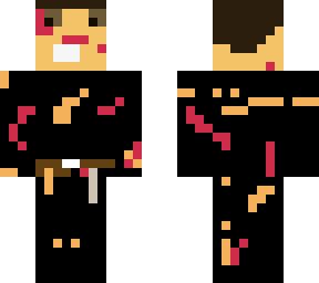 bruised anakin skywalker