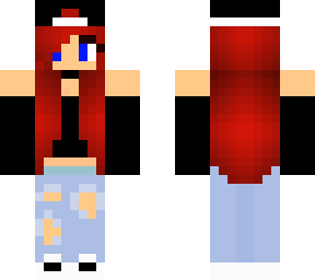 james's skin 3