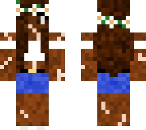 vitiligo girl with dark brown hair and dark skin and white flower crown.