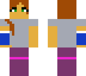 girl with broken arm
