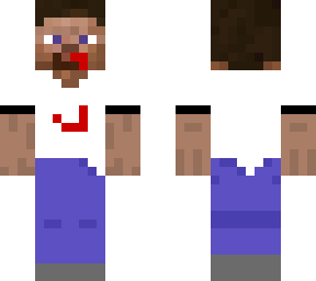 steve has bloddy nosie