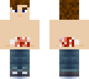 mike (bandaged)