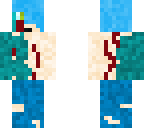 infekid