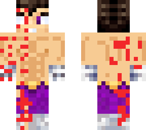 vegetta quemado