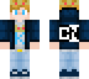 karl's skin