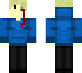 ouchied boy