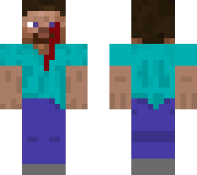 steve with an ouchie