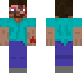 steve hurted
