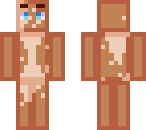 vitilic tan base