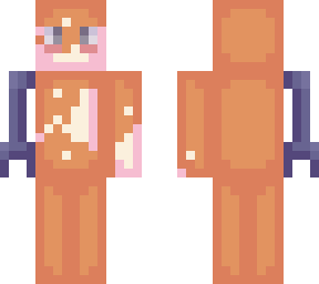 bionic arm vitilic tan base