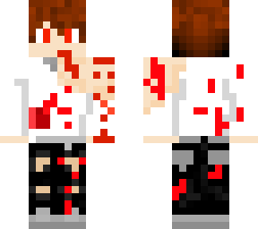 mi skin 2.0