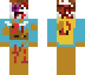 injury
