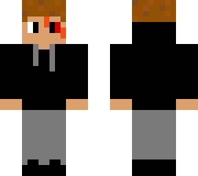 scar eye boy v2
