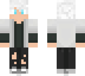 albino boy