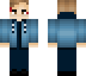 lenni-kim bad buzz skin