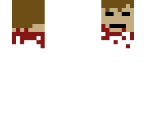 severed head