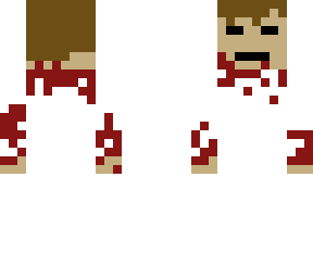 severed head