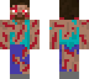 badly hurt survivor steve