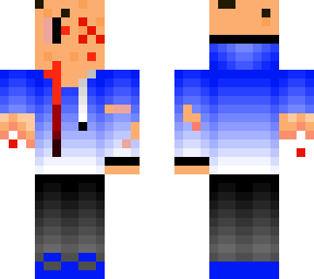 very injured man