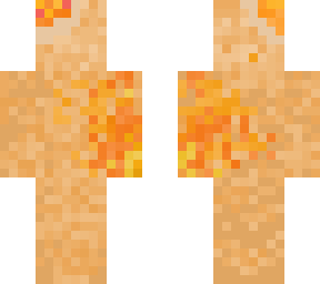 burning hand
