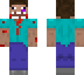 steve after fight