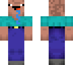 bald noob