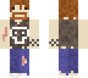 danny's skin