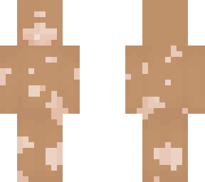 warm toned medium skin base with vitiligo