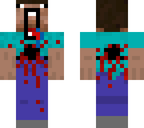 bloody noob