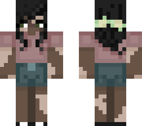 ~ vitiligo casual ~