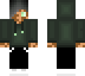 vitiligo boy