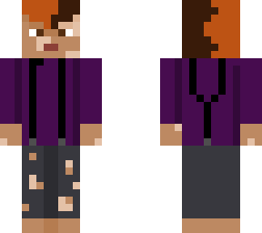 person w/vitiligo (cna be nb/girl/boy), suspenders, and split-dye