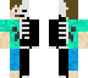 skin and bones