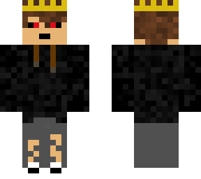 my skin bruv