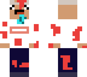 beat up noob with no hair and has caner