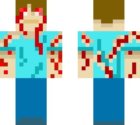 broken guy