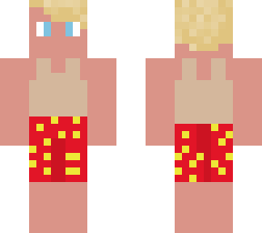 sunburn
